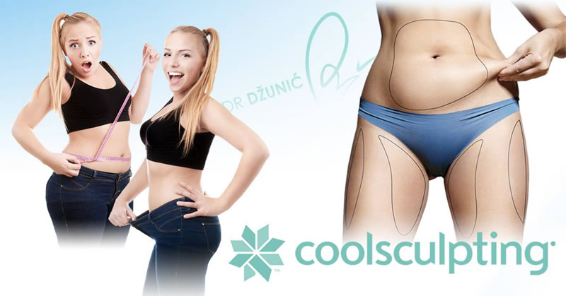 coolsculpting